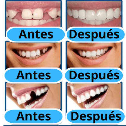 MOLDE DE RESINA PARA DENTADURA